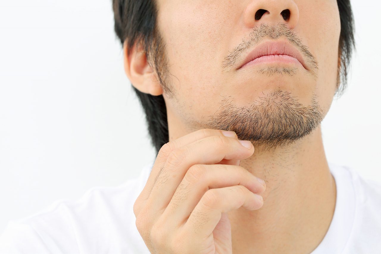 毛深い・青ひげなどの悩みを解消する方法は？ | 福井メンズ脱毛サロン